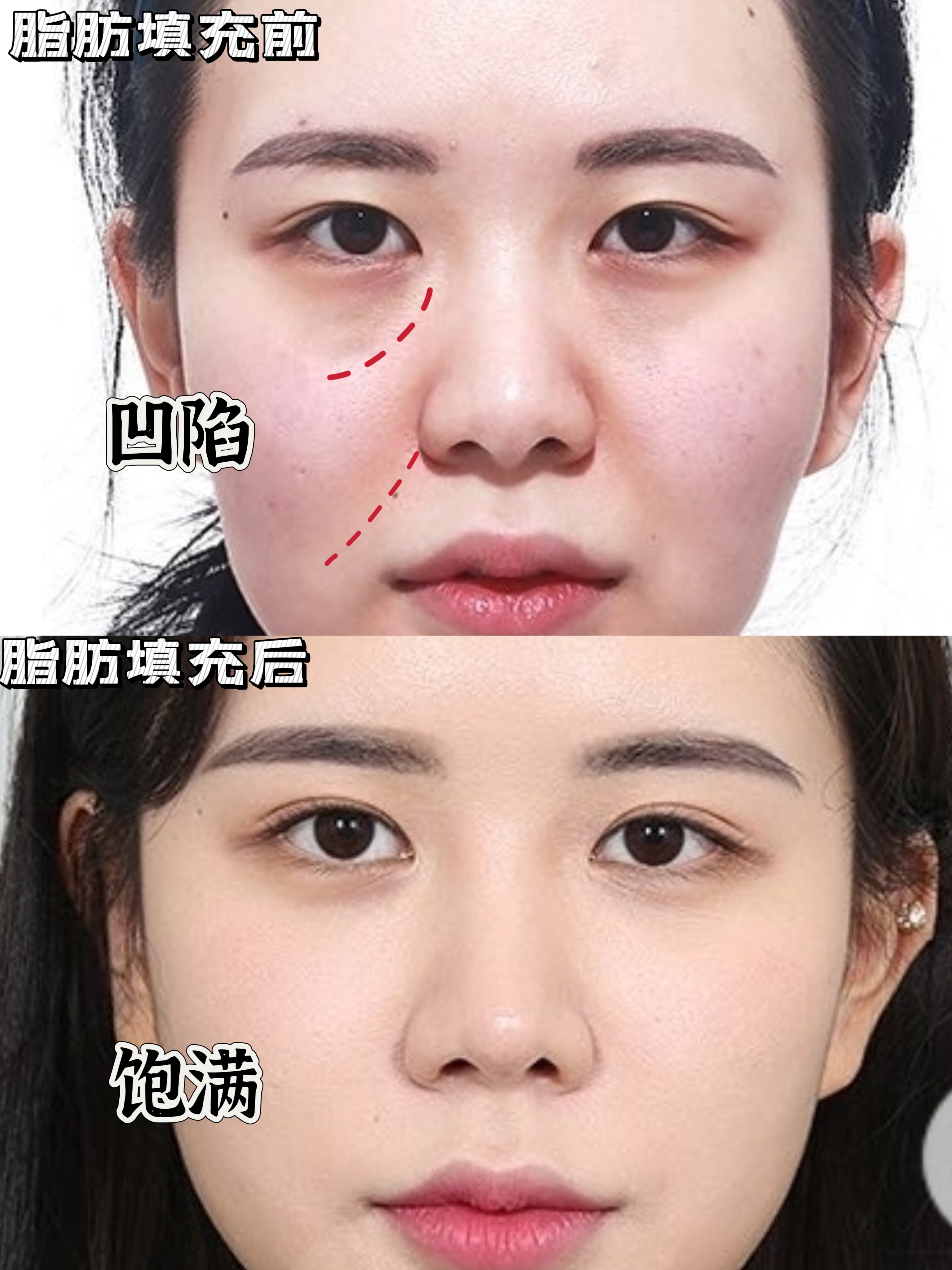 整容整型的区别 整容手术和整形手术的区别 