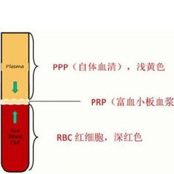 ppppc区别 pc和pp有什么区别吗 