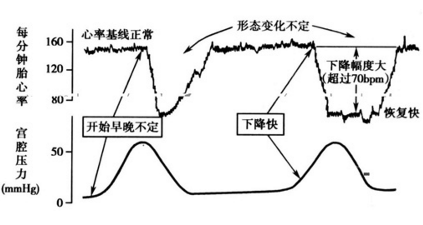 急速跟加速的区别 急速跟加速的区别是什么 