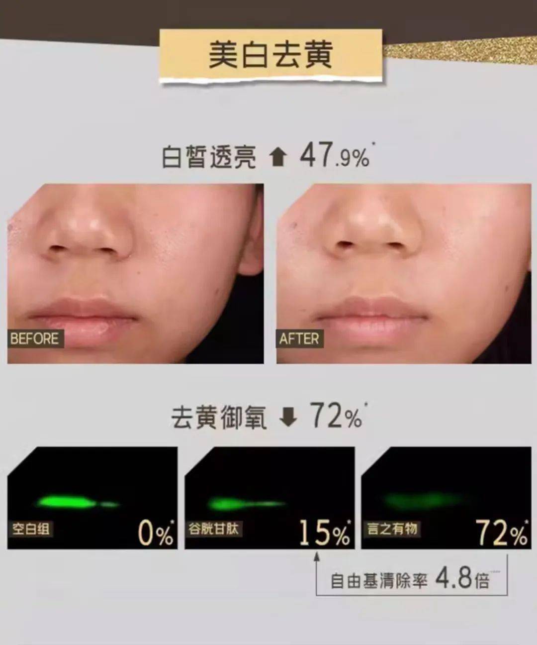 bp与vc的区别 vc和bp是什么意思 